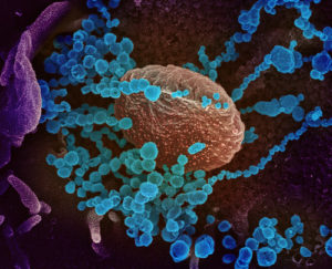 新型コロナウィルスに「HIVのような変異」を科学者らが発見：この変異によりSARSよりも100倍〜1000倍感染率が高まる